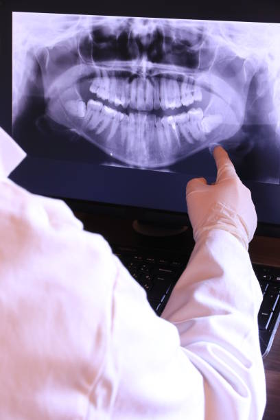 Best Emergency Wisdom Teeth Removal in Smith Valley, NV